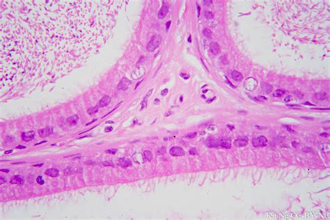 Pseudostratified Columnar Epithelium Located