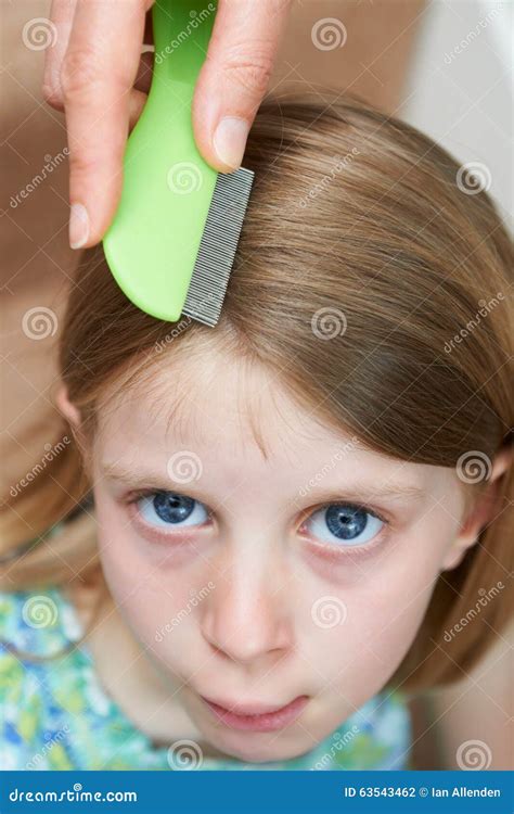 Head Louse Treatment and Prevention Stock Photo - Image of person, portrait: 63543462