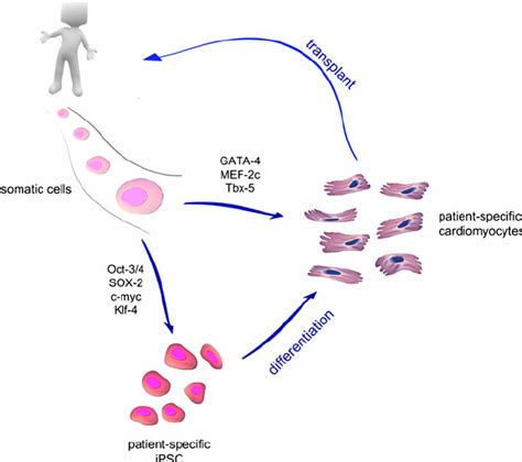 Somatic cell reprogramming to obtain patient-specific cardiomyocytes ...