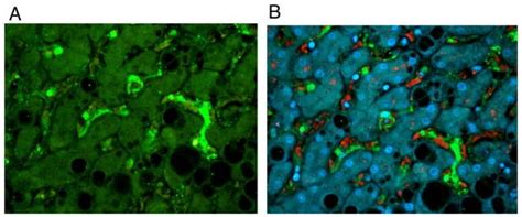 F4/80 Antibody: Mouse Macrophage and Microglial Marker - Creative Diagnostics