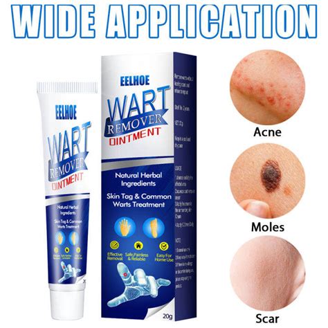 Eelhoe Warts Remover Cream Antibacterial Ointment Wart Treatment Cream ...