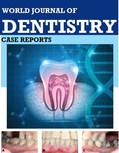 World Journal of Dentistry and Case Reports | Boston Science Publishing