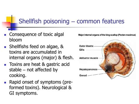 PPT - Toxicology course Case presentation Shellfish poisoning PowerPoint Presentation - ID:3632414