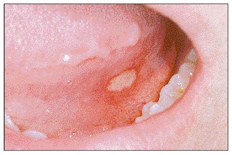 9 – Orofacial Lesions | Pocket Dentistry