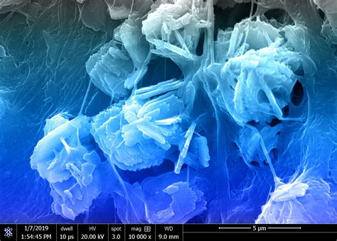 Improving biomaterials design for bone regeneration