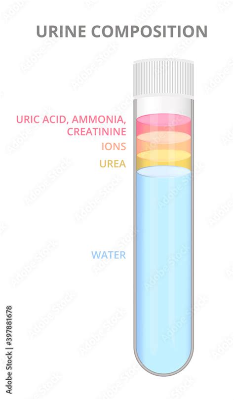 Urine composition, the composition of urine, urine components. Uric ...