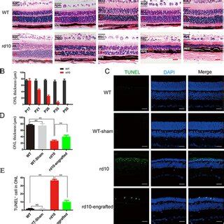 hiPSC-RPE cells preserved of photoreceptor in rd10 mice. a Histology of... | Download Scientific ...