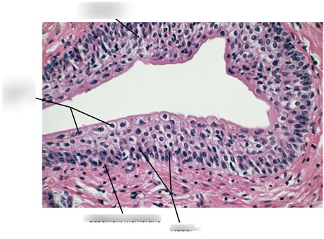 Transitional Epithelium Histology