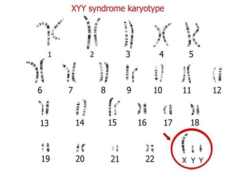 Y Chromosome - The Definitive Guide | Biology Dictionary