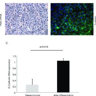 Mesenchymal differentiation of mesenchymal stem cells. Differentiation ...