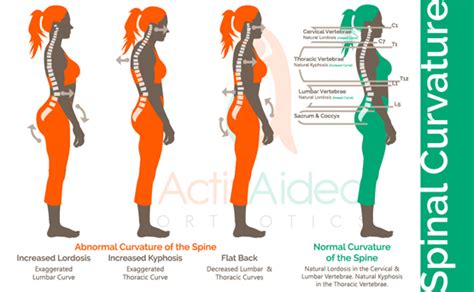 Posture: The Good, The Bad, & The Ugly - ActivAided