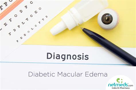 Diabetic Macular Edema: Causes, Symptoms And Treatment | Netmeds