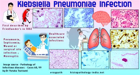 Pathology of Klebsiella Pneumoniae Infection - Dr Sampurna Roy MD