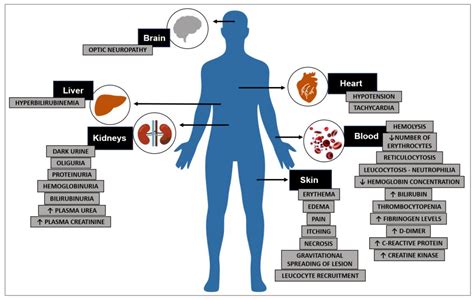 Toxins | Free Full-Text | Systemic Loxoscelism, Less Frequent but More Deadly: The Involvement ...