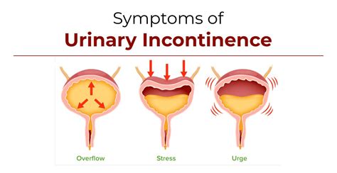 Symptoms of Urinary Incontinence - Urologist Ahmedabad