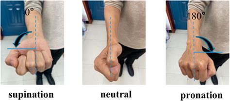 Frontiers | Estimation of the Continuous Pronation–Supination Movement by Using Multichannel EMG ...