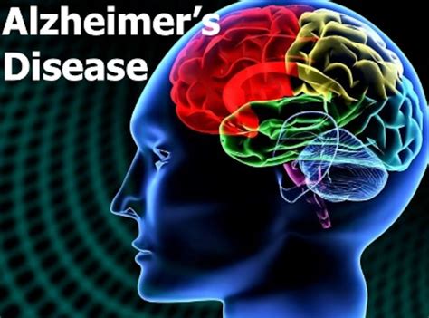 National Alzheimer ’s Disease Awareness Month: Wright-Patt ...