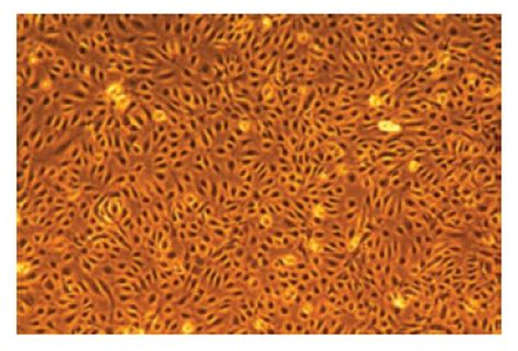 EndoGROTM Human Umbilical Vein Endothelial Cells (HUVEC) | SCCE001