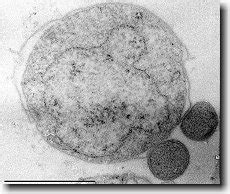 8.15F: Nanoarchaeum and Aciduliprofundum - Biology LibreTexts