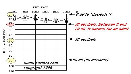 How to Understand Your Hearing Test - Hearing Aid Resource for Consumers