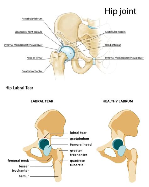 Hip Labral Tear Tests: EPs Chiropractic and Functional Medicine Team