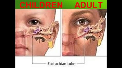 Eustachian Tube Anatomy