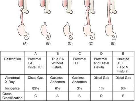 . Anatomic Disorders of the Esophagus | Obgyn Key