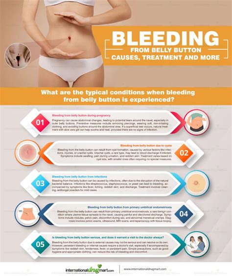 bleeding from belly button: Causes, Treatment and More ...