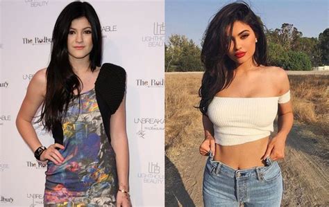 [最新] makeup kylie jenner before surgery daily mail 127361