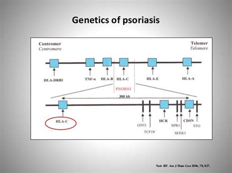 Psoriasis