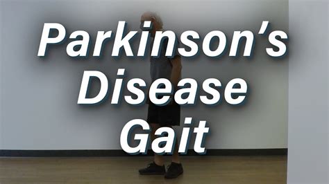 Parkinson's Disease Gait - Moderate Severity - YouTube