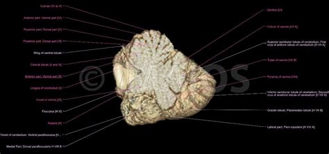 Cerebellum: Cerebellar fissures, Vermis of cerebellum [I-X], Hemisphere of cerebellum [H II - H ...