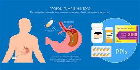 Proton Pump Inhibitors (PPI) - Medic Drive