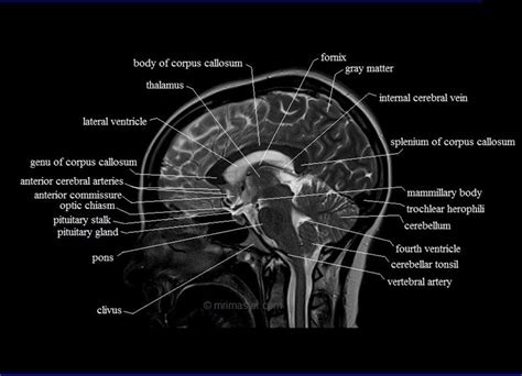 Cross Sectional Brain Anatomy