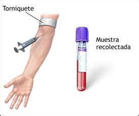 Electrolitos Plasmáticos - Enciclopedia Médica Ferato