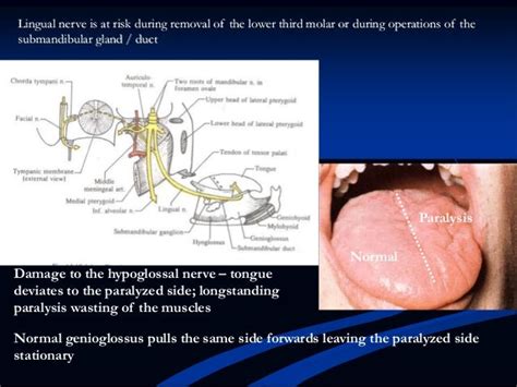 (18)hypoglossal nerve