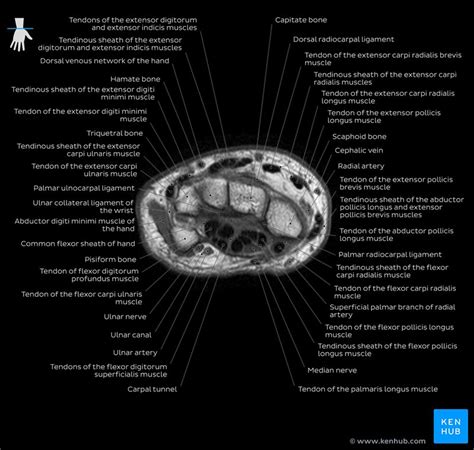 Radiological anatomy : X-ray, CT, MRI | Kenhub