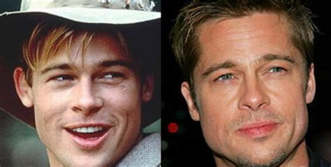 Brad Pitt Plastic Surgery Before And After Facelift, Nose Job