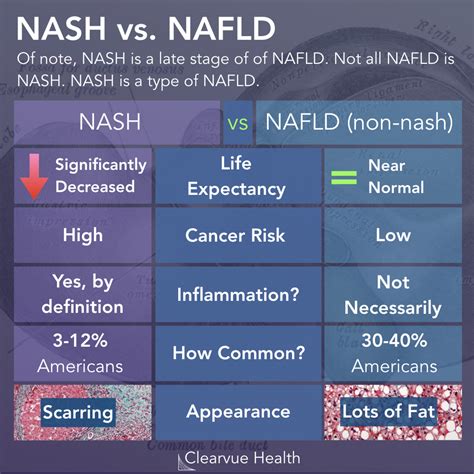 Is NASH Disease Reversible? | Visualized Health