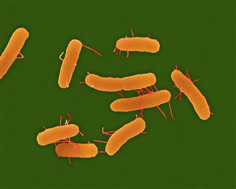 Salmonella Typhi Under A Microscope