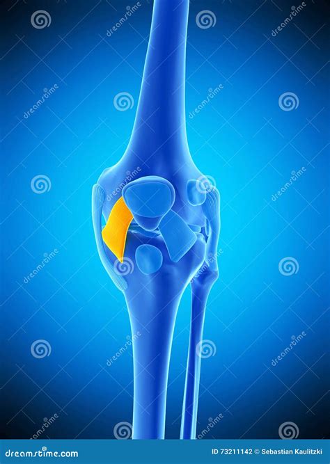 Anatomy_Patellar Tendon Rupture Vector Illustration | CartoonDealer.com ...