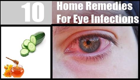 Easy and effective Home Remedies for Eye Infection! | Netmarkers- Submit Original Articles, Stories