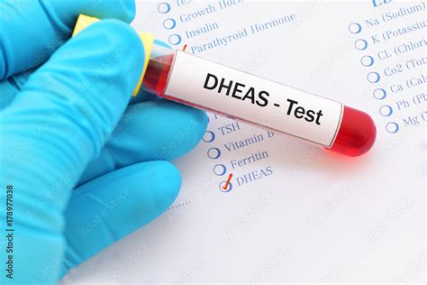 Blood sample with requisition form for DHEAS hormone test Stock Photo ...