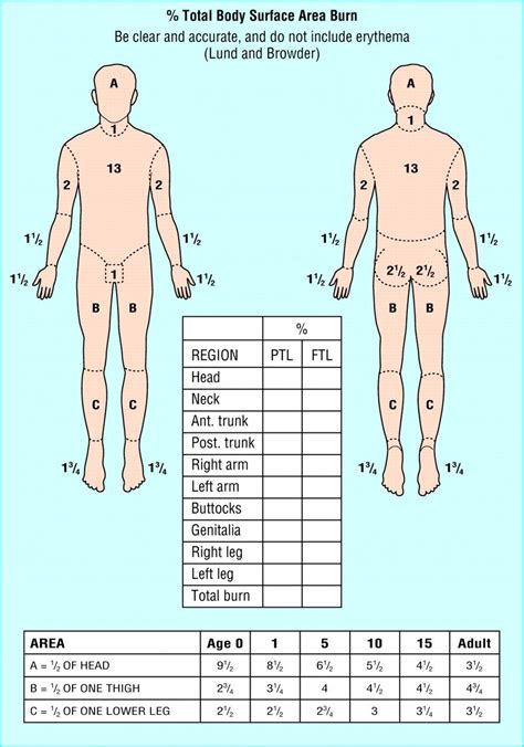 Rule of 9's burn chart | Rule of nines, Burns, Nursing study