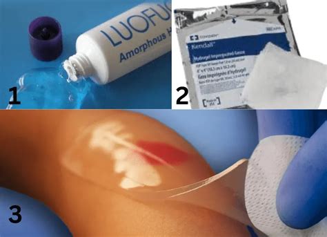 What Is Hydrogel Wound Dressing? See Its 3 Amazing Types! - EcofriendlyHacks