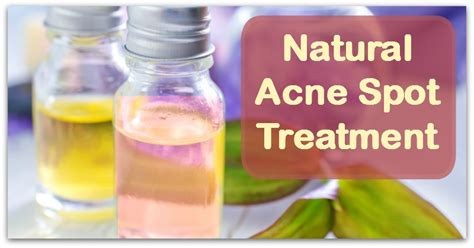 Natural Acne Spot Treatment - Natural Holistic Life