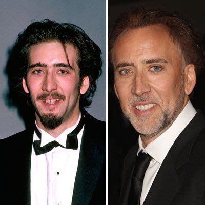 Behold, the power of dentistry: Nicolas Cage's smile before and after. #dentistry Celebrity ...