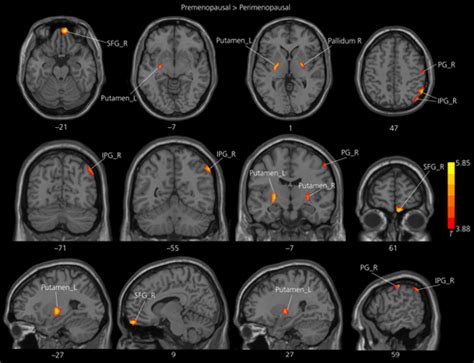 Journal of Neuroendocrinology - Wiley Online Library