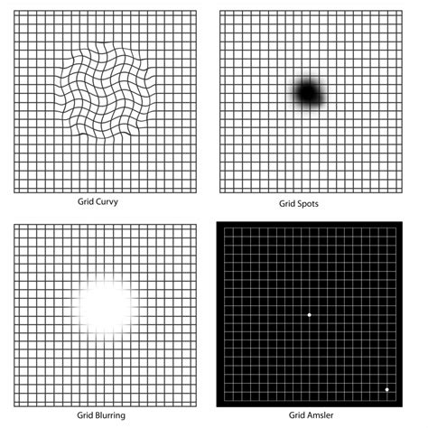 Macular Degeneration Grid Printable