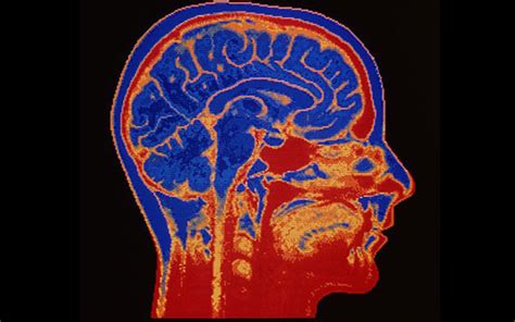 Brain Imaging in the Information Age - McGill Reporter